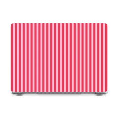 Perfect Stripes | Pink Stripes Laptop Shell